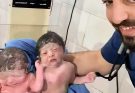 👯 Identical Twin Sisters Just Born! 😍💖 | Double the Cuteness, Double the Joy 🐣