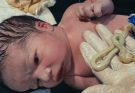 HIE + MAL Grade III Newborn Care | NICU Protocol | Life-Saving Nursing