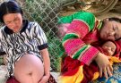 The single mother bravely overcame her grief for the sake of her little angel. | Ly Tieu Vy|