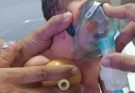 Critical Newborn baby | Chest Physiotherapy, High Oxygen Support & Deep Suction | Emergency Care
