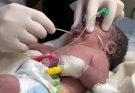 Critical NICU Baby | Delayed Cry at Birth | Low Oxygen & Emergency Care 💙