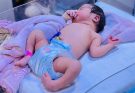 Clubfoot Physiotherapy for Newborn | NICU Baby Foot Correction Treatment.